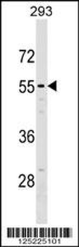 NT5D2 Antibody (Center)
