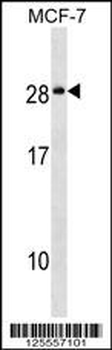 NKAI4 Antibody (C-term)