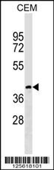 CC113 Antibody (C-term)
