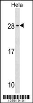 RAB35 Antibody (C-term)