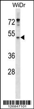 ENPP4 Antibody (Center)