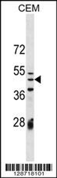 IZUM1 Antibody (N-term)