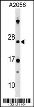DRAP1 Antibody (N-term)