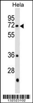 GALNT13 Antibody (Center)