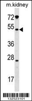 GALNT13 Antibody (Center)