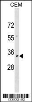 NKX2-6 Antibody (N-term)