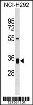 GNPTG Antibody (C-term)