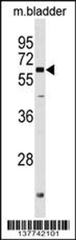 PGM2L1 Antibody (C-term)