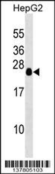 TCEAL6 Antibody (N-term)