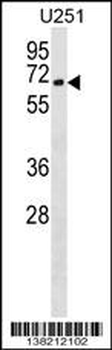 CORO2B Antibody (N-term)