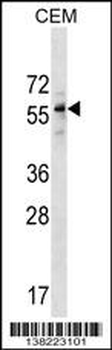 DPH2 Antibody (N-term)