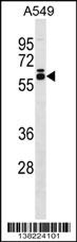DUS2L Antibody (C-term)