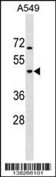 GTPBP5 Antibody (N-term)