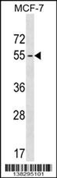 MAGEB18 Antibody (Center)