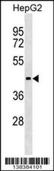 ZBTB26 Antibody (N-term)