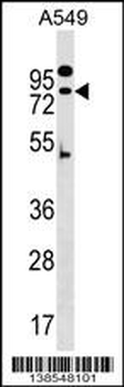 ZNF480 Antibody (N-term)