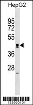 ZNF556 Antibody (N-term)