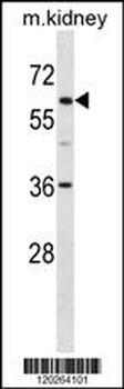 TFE3 Antibody (C-term)