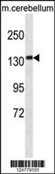 CAMSAP3 Antibody (N-term)