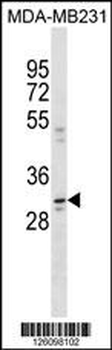 CCDC28A Antibody (N-term)