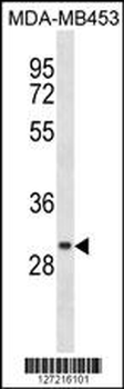 CCDC24 Antibody (N-term)