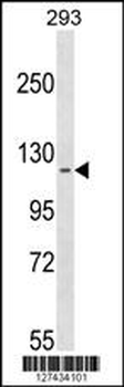 CCDC147 Antibody (N-term)