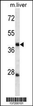 TRIM44 Antibody (C-term)