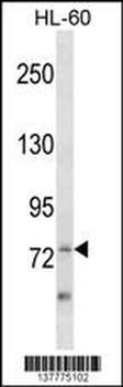 ZBTB39 Antibody (Center)