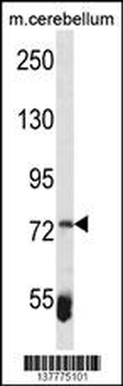 ZBTB39 Antibody (Center)