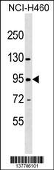 ZNF484 Antibody (N-term)
