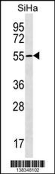 RNF150 Antibody (N-term)