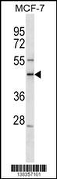 SCML1 Antibody (N-term)
