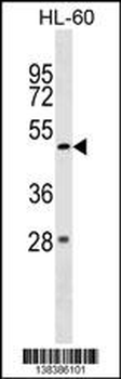 ZBTB47 Antibody (Center)