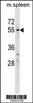 WFIKKN2 Antibody (C-term)