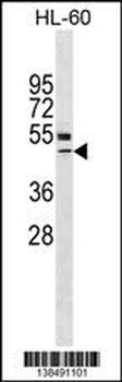 VDR Antibody