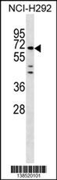 MIER3 Antibody (Center)