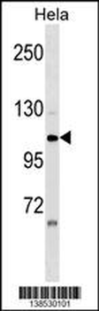 ZNF33A Antibody (N-term)