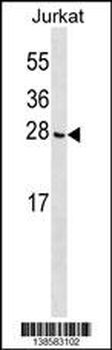 CGGBP1 Antibody (C-term)