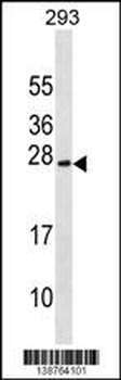 EXOSC1 Antibody (C-term)