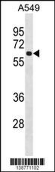 FCRL1 Antibody (C-term)