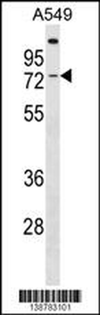 GBP3 Antibody (C-term)