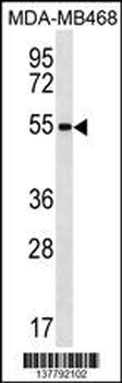 ZNF621 Antibody (N-term)