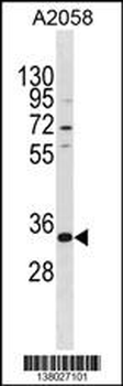 TGIF2LX Antibody (Center)