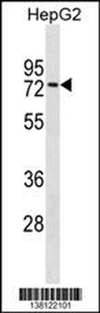 ZNF614 Antibody (Center)