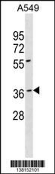 BARHL1 Antibody (N-term)