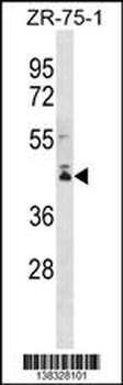 PCMTD2 Antibody (C-term)