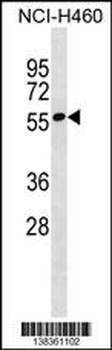 ZNF302 Antibody (N-term)
