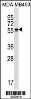 SOHLH2 Antibody (Center)