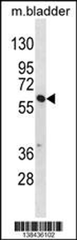 SNX30 Antibody (C-term)