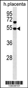 SNX30 Antibody (C-term)